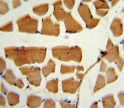 BMI1 Antibody Skeletal Muscle IHC. Immunohistochemistry analysis of FFPE human skeletal muscle stained with BMI1 antibody.