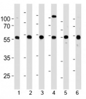 YY1 antibody western blot analysis in 1) 293, 2) HL-60, 3) SiHa, 4) K562, 5) THP-1 and 6) U266 lysate. Predicted molecular weight ~45 kDa, observed molecular weight 45~65 kDa.