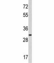Western blot analysis of MARCKS antibody and HeLa lysate. Predicted molecular weight ~32 kDa.
