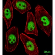 Immunofluorescent analysis of U251 cells using KLF4 antibody; Ab was diluted at 1:25 dilution. Alexa Fluor 488-conjugated goat anti-rabbit lgG was used as the secondary Ab (green). Cytoplasmic actin was counterstained with Dylight Fluor 554 (red) conjugated Phalloidin (red).