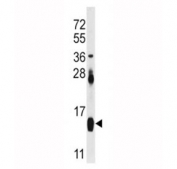 FABP4 Antibody Mouse Heart WB. Western blot analysis of FABP4 antibody and mouse heart tissue lysate. Predicted molecular weight ~15 kDa.