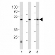 HNF4A antibody western blot analysis in 1) 293, 2) HepG2 cell line and 3) rat liver tissue lysate. Predicted molecular weight ~50 kDa.