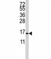 Western blot analysis of S100A11 antibody and CEM lysate. Predicted molecular weight 12~15 kDa.