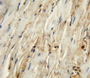 CD105 Antibody Mouse Heart IHC. CD105 antibody immunohistochemistry analysis in formalin fixed and paraffin embedded mouse heart tissue.