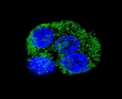 CD36 Antibody HepG2 Cells IF. Confocal immunofluorescent analysis of HepG2 cells demonstrates CD36 expression using a CD36 antibody followed by an Alexa Fluor 488 conjugated goat anti rabbit IgG secondary antibody (green). CD36, also known as Fatty Acid Translocase, is a multifunctional scavenger receptor that mediates long chain fatty acid uptake and contributes to lipid metabolism and cellular energy homeostasis. Predominantly membranous and cytoplasmic staining is observed, consistent with the known localization of CD36 in metabolically active cells. DAPI nuclear counterstain identifies cell nuclei (blue). These results support the utility of CD36 Antibody for studies of fatty acid transport, scavenger receptor biology, metabolic regulation, and cancer metabolism.