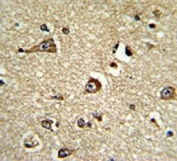 Phosphoglycerate Dehydrogenase Antibody Human Brain IHC. Immunohistochemistry staining of FFPE human brain tissue with Phosphoglycerate Dehydrogenase Antibody. The tissue section was incubated with PHGDH antibody and developed using chromogenic detection. Phosphoglycerate Dehydrogenase Antibody / PGDH Antibody demonstrates cytoplasmic staining consistent with PHGDH expression and supports studies of serine biosynthesis, amino acid metabolism, metabolic enzyme regulation and neurological metabolic pathways.