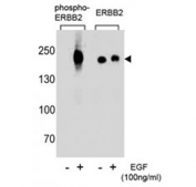 Phospho-ErbB2 (pY1248) Antibody EGF-Stimulated WB. Western blot analysis of human A431 cell lysates treated with or without EGF (100 ng/ml) using Phospho-ErbB2 (pY1248) Antibody demonstrates a strong band at approximately 185 kDa in EGF-stimulated samples, consistent with the predicted molecular weight of phosphorylated ErbB2 / HER2, while untreated samples show minimal signal; parallel blotting with a non-phospho ErbB2 antibody confirms total receptor presence across conditions, highlighting phosphorylation-dependent activation at Tyr1248.