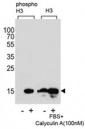 Phospho-Histone H3 Antibody (pS10) / Western Blot Phosphorylation Response Antibody for WB. Western blot analysis of HIST1H3A / Histone H3 Ser10 phosphorylation in human HeLa cell extracts untreated (-) or treated (+) with FBS and Calyculin A (100 nM) using Phospho-Histone H3 Antibody (pS10) / Western Blot Phosphorylation Response Antibody (left) compared to a non-phospho Histone H3 antibody (right). A band is detected at the predicted molecular weight of approximately 15 kDa corresponding to Histone H3, with increased signal intensity in treated samples reflecting enhanced Ser10 phosphorylation. The non-phospho antibody detects total Histone H3 with relatively consistent band intensity across conditions, confirming phosphorylation-dependent signal specificity.