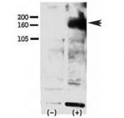 Phospho-ERBB4 (pY1162) Antibody EGF-Stimulated WB. Western blot analysis of human FG pancreatic carcinoma cell lysates treated with or without EGF (50 ng/ml, 15 min) using Phospho-ERBB4 (pY1162) Antibody detects a band at approximately 160â180 kDa in stimulated samples, consistent with the predicted molecular weight of phosphorylated HER4 / ERBB4, while untreated samples show reduced signal, supporting ligand-induced receptor activation at Tyr1162.