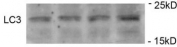 Immunoblots of SH-SY5Y cells treated with MPP+ for 24h was probed with phospho-LC3C antibody. The data shows that treatment with MPP+ showed no significant change in level of LC3.