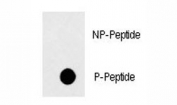 Phospho-Fas Antibody Dot Blot. Dot blot analysis of phospho-Fas antibody. 50ng of phos-peptide or nonphos-peptide per dot were spotted. P-Pab=phos-Ab; P-Peptide=phos-peptide; NP-Peptide=nonphos-peptide.