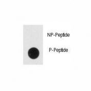 Phospho-NSE Antibody Dot Blot. Dot blot analysis of phospho-NSE antibody. 50ng of phos-peptide or nonphos-peptide per dot were spotted.