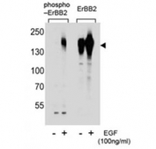 Phospho-ErbB2 (pS1107) Antibody EGF-Stimulated WB. Western blot analysis of human A431 cell lysates treated with or without EGF (100 ng/ml) using Phospho-ErbB2 (pS1107) Antibody detects a band at approximately 185 kDa in EGF-stimulated samples, consistent with the predicted molecular weight of phosphorylated ErbB2 / HER2, while untreated samples show reduced signal; parallel detection with a nonphospho ErbB2 antibody confirms total receptor expression across conditions, supporting phosphorylation-dependent regulatory signaling at Ser1107.