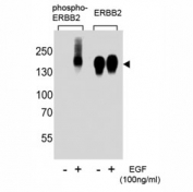 Phospho-ErbB2 (pY1139) Antibody EGF-Stimulated WB. Western blot analysis of human A431 cell lysates treated with or without EGF (100 ng/ml) using Phospho-ErbB2 (pY1139) Antibody detects a band at approximately 185 kDa in EGF-stimulated samples, consistent with the predicted molecular weight of phosphorylated ErbB2 / HER2, while untreated samples show reduced signal; parallel detection with a nonphospho ErbB2 antibody confirms total receptor expression across conditions, supporting phosphorylation-dependent signal integration at Tyr1139.