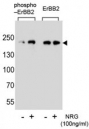 Phospho-ErbB2 (pY1140) Antibody NRG-Stimulated WB. Western blot analysis of human SK-BR-3 cell lysates treated with or without neuregulin (NRG, 100 ng/ml) using Phospho-ErbB2 (pY1140) Antibody detects a band at approximately 185 kDa in stimulated samples, consistent with the predicted molecular weight of phosphorylated ErbB2 / HER2, while untreated samples show reduced signal; parallel detection with a nonphospho ErbB2 antibody confirms total receptor expression across conditions, supporting phosphorylation-dependent signaling at Tyr1140.