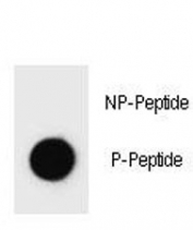 Phospho-ErbB2 (pY1140) Antibody Dot Blot Specificity. Dot blot analysis of Phospho-ErbB2 (pY1140) Antibody demonstrates strong signal for the phosphorylated peptide and no detectable binding to the corresponding non-phosphorylated peptide, confirming phospho-specific recognition of ErbB2 / HER2 at Tyr1140. Approximately 50 ng of phospho-peptide or non-phospho peptide was applied per spot.