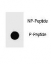 Dot blot analysis of Phospho-PARP1 (S864) Antibody. 50ng of phos-peptide or nonphos-peptide per dot were spotted.