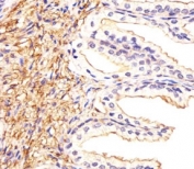 Immunohistochemical analysis of paraffin-embedded human prostate section using ATF6 beta antibody at 1:25.