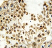 IHC analysis of FFPE human testis tissue stained with ACE2 antibody