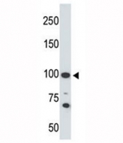Western blot testing of Angiotensin-converting enzyme 2 antibody and 293 cell lysate. Predicted molecular weight: 90-100 kDa.