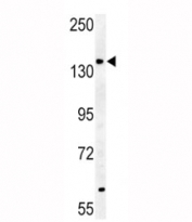 ABCB4-S639 western blot analysis in mouse heart tissue lysate