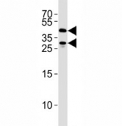 SIRT3 Antibody HEK293 Cell WB. SIRT3 antibody western blot analysis in 293 cell lysate. Predicted size: 44/28 kDa (full/processed)
