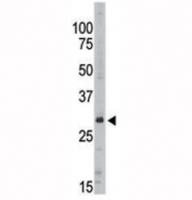 Western blot analysis of SIRT5 antibody in Jurkat lysate