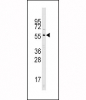 Western blot analysis of Cdc25A antibody and mouse kidney tissue lysate. Predicted molecular weight: 59-70 kDa.
