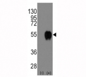Western blot analysis of CD14 antibody and 293 cell lysate (2 ug/lane) either nontransfected (Lane 1) or transiently transfected with the CD14 gene (2).