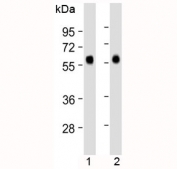 Western blot testing of 1) human liver and 2) human lung lysate with CD14 antibody at 1:2000 dilution. Expected molecular weight: 40-55 kDa depending on glycosylation level.