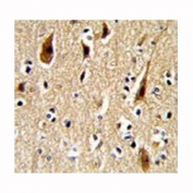 IHC analysis of FFPE human brain with APP antibody