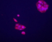 Immunofluorecence staining of GPC3 antibody on HepG2 cells. The cells were acetone fixated. Ab dilution of 1:50. Original magnification 1:400. (Data and protocol courtesy of Dr. Mariana Dabeva, Department of Medicine at Albert Einstein College of Medicine.)