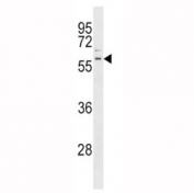 PRKN Antibody Human K562 Leukemia Cell WB. Western blot analysis of human K562 leukemia cell lysate was performed with PRKN Antibody. A specific band is detected at approximately 55-60 kDa, within the expected molecular weight range of 50-60 kDa for Parkin. Multiple smaller isoforms of Parkin have also been reported. This PRKN Antibody demonstrates detection of Parkin RBR E3 ubiquitin ligase in human K562 leukemia cells.