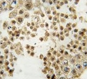 PRKN Antibody Human Testis IHC. IHC staining of FFPE human testis tissue was performed with PRKN Antibody. Positive PRKN/Parkin staining is observed in cells within the seminiferous tubules, with predominantly cytoplasmic signal. This PRKN Antibody demonstrates localization of Parkin RBR E3 ubiquitin ligase in human testis tissue.