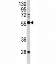 FLI1 Antibody Mouse Lung WB. Western blot analysis of FLI1 antibody and mouse lung tissue lysate.