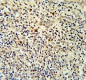 FLI1 Antibody Tonsil Immunohistochemistry. FLI1 antibody IHC analysis in formalin fixed and paraffin embedded human tonsil tissue.