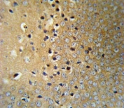 VHL Antibody Mouse Brain IHC. Immunohistochemistry staining of FFPE mouse brain tissue using VHL antibody demonstrates widespread cytoplasmic staining throughout neuronal populations, consistent with expression of Von Hippel-Lindau protein (VHL). VHL is a tumor suppressor protein that regulates hypoxia-inducible factor (HIF) signaling and plays a central role in cellular oxygen sensing, metabolic adaptation, and maintenance of cellular homeostasis. The observed staining pattern is consistent with the established role of VHL in regulating oxygen-responsive pathways within metabolically active neural tissues. These findings support the utility of VHL antibody for studies of hypoxia signaling, HIF regulation, and tumor suppressor-associated cellular pathways in the nervous system.