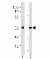 TBP / TATA Binding Protein antibody western blot analysis in (1) K562 and (2) U251 lysate. Observed molecular weight: 35-43 kDa.