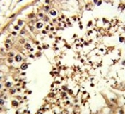 TBP / TATA Binding Protein Antibody U251 IF Testis Tissue IHC. Immunohistochemistry analysis of FFPE human testis tissue stained with TBP antibody.