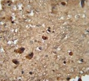RAN antibody immunohistochemistry analysis in formalin fixed and paraffin embedded human brain tissue.