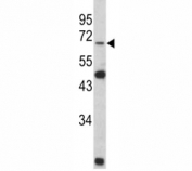 Western blot analysis of Lamin B2 antibody and Y79 lysate