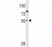 PAX8 Antibody / Differentiated vs Dedifferentiated Tumor Marker Antibody western blot analysis in human HL-60 cell lysate. A band is detected at approximately 55-60 kDa, above the predicted molecular weight of Paired box protein Pax-8 (PAX8) at ~48 kDa. The upward shift in apparent molecular weight is consistent with post-translational modification or altered electrophoretic mobility of this nuclear transcription factor. This banding pattern supports detection of PAX8 and aligns with known variability in migration associated with transcriptional regulation and isoform expression.