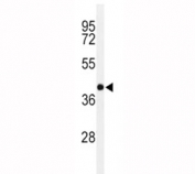 Western blot analysis of PAX-6 in Y79 lysate. Predicted molecular weight ~48kDa.