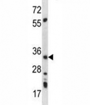 AMPK beta 2 antibody western blot analysis in mouse kidney tissue lysate