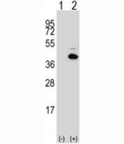 PITX1 Antibody Transfected Cell WB. Western blot testing of human 293 cell lysates with PITX1 Antibody. Lane 1: non-transfected 293 cell lysate; Lane 2: 293 cells transiently transfected with the PITX1 gene. A specific band was detected at approximately 34 kDa in PITX1-transfected cells, consistent with the predicted molecular weight of PITX1. PITX1 Antibody / Developmental Transcription Factor Antibody supports detection of pituitary homeobox 1 expression and studies of homeobox proteins, transcriptional regulation, developmental biology and gene expression pathways.