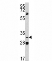 PITX1 Antibody Human Lung Cancer Cell WB. Western blot testing of human NCI-H460 cell lysate with PITX1 Antibody. A specific band was detected at approximately 34 kDa, consistent with the predicted molecular weight of PITX1. PITX1 Antibody / Developmental Transcription Factor Antibody supports detection of pituitary homeobox 1 expression and studies of homeobox transcription factors, developmental gene regulation, cellular differentiation and cancer biology pathways.