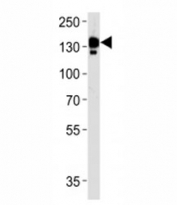 Ceruloplasmin Antibody Human Plasma WB. Western blot analysis of human blood plasma lysate using Ceruloplasmin Antibody / Plasma Copper-Binding Protein Antibody demonstrates a strong band at approximately 130 kDa, consistent with the expected molecular weight of mature Ceruloplasmin (CP). Ceruloplasmin is the principal copper-carrying glycoprotein in plasma and plays a central role in systemic copper transport, iron metabolism, and maintenance of metal ion homeostasis. Synthesized primarily by the liver and secreted into circulation, Ceruloplasmin functions as a multicopper ferroxidase that oxidizes ferrous iron to ferric iron, facilitating iron loading onto transferrin and supporting efficient iron transport throughout the body. The prominent plasma-associated signal is consistent with the abundant circulating expression of Ceruloplasmin and its established role in mineral transport, metabolic regulation, and physiologic homeostasis.