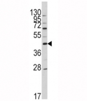 Western blot analysis of APOA5 antibody and HL-60 lysate. Predicted molecular weight: ~41kDa.
