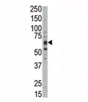 Western blot analysis of DYRKB antibody and mouse kidney tissue lysate. Predicted molecular weight :64-75 kDa (isoforms 1-3).