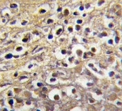 IHC analysis of FFPE human placenta tissue stained with Aromatase antibody